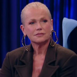 Estenose de canal faz Xuxa passar por cirurgia na coluna